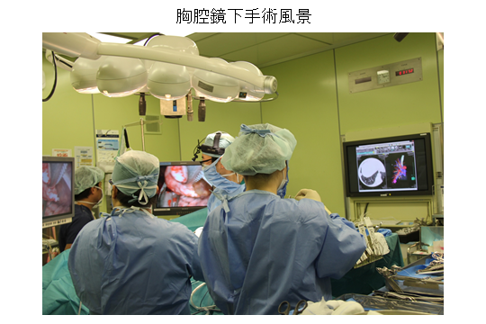 胸腔鏡下手術風景