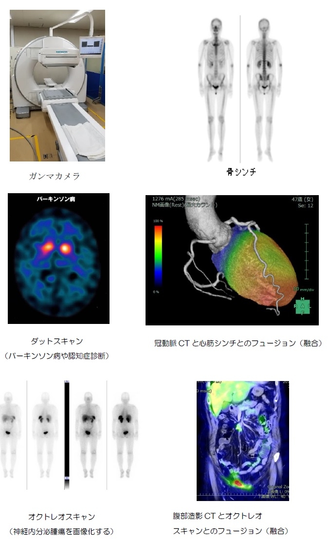 核医学RI検査.jpg