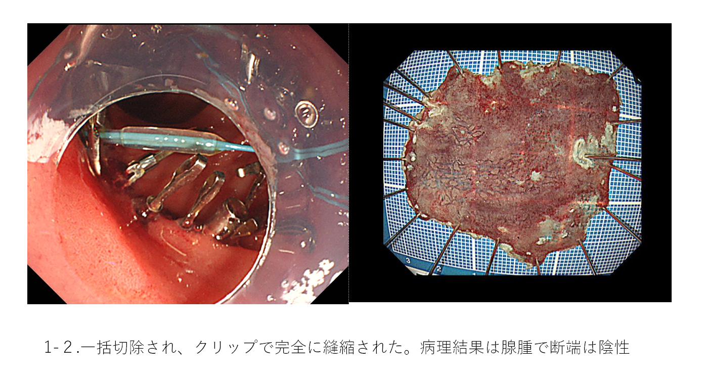 消化器内科②.png