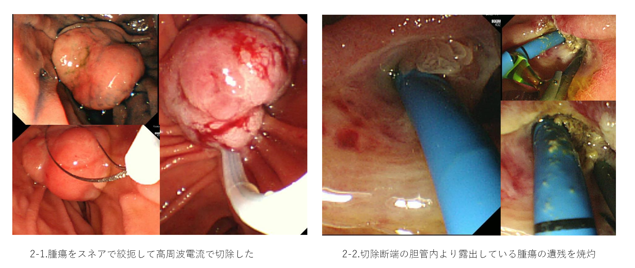 消化器内科③・④.png