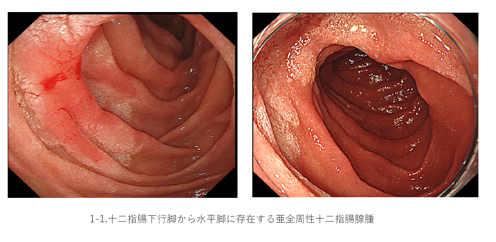 消化器内科①.png