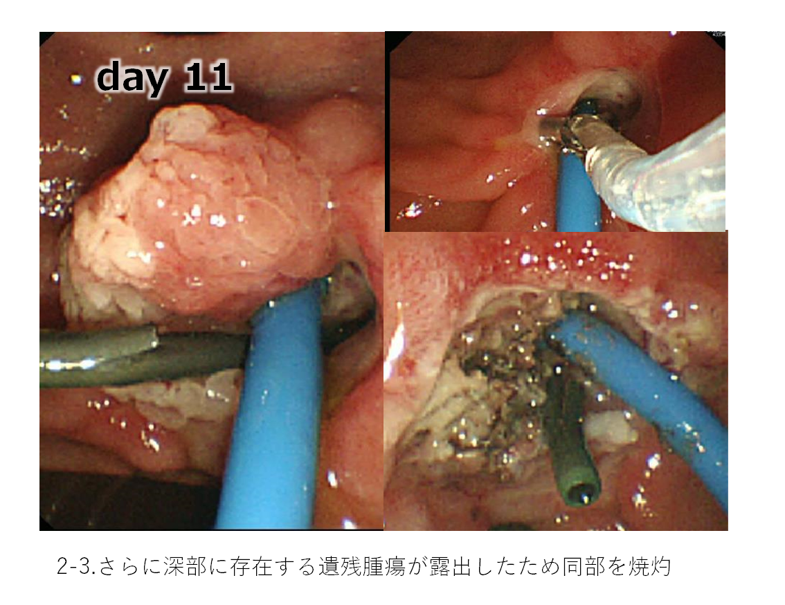 消化器内科⑤.png