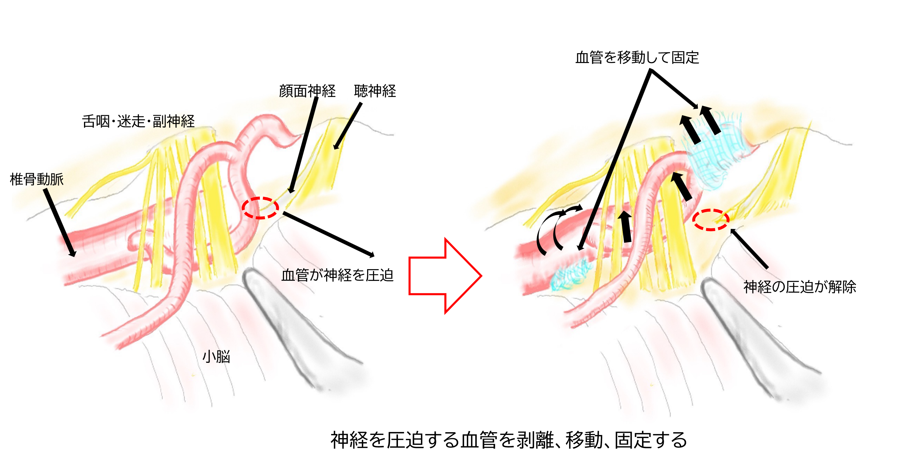 「取り扱う主な疾患」画像②-2.png